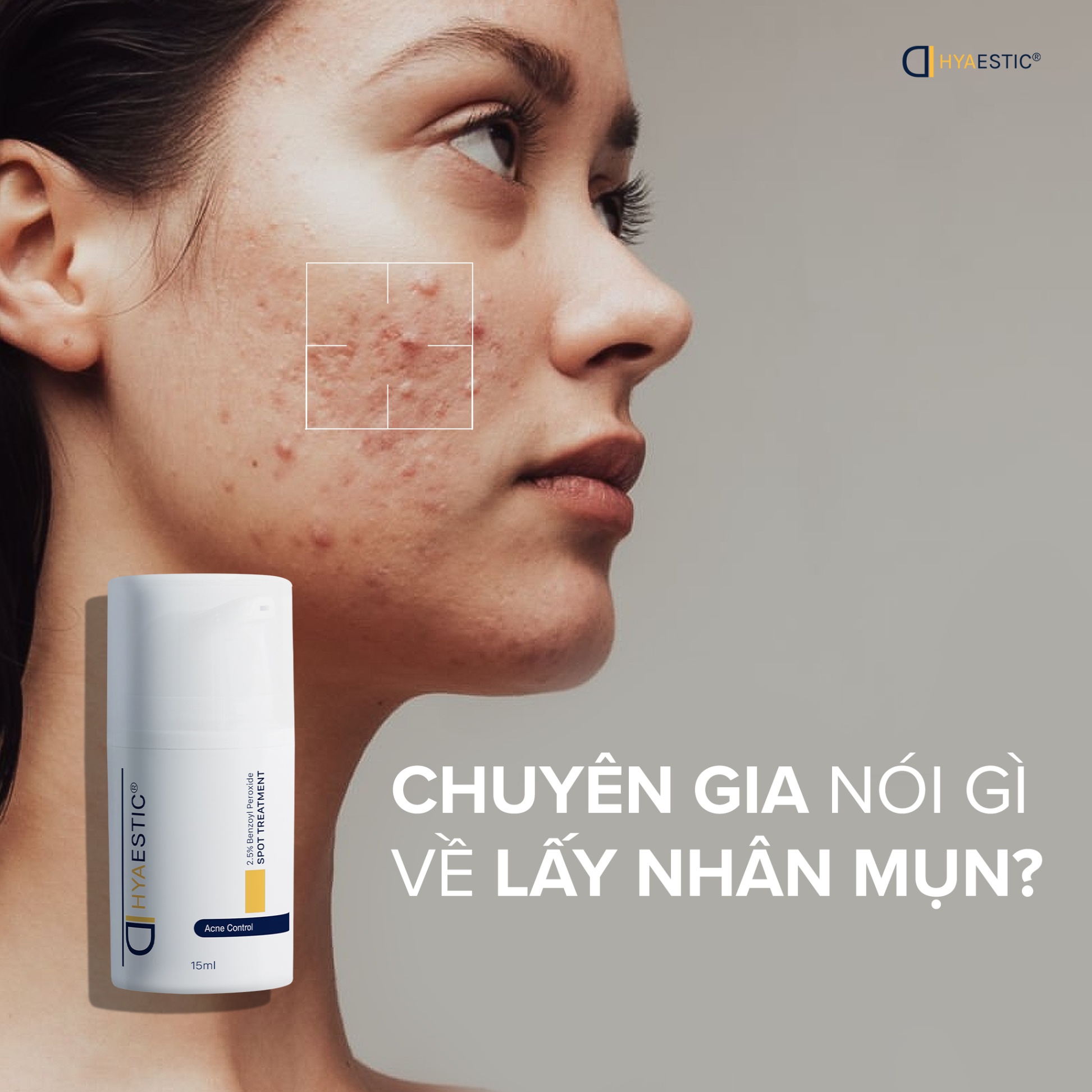 Gel Hỗ Trợ Giảm Mụn Sưng Viêm Hyaestic Spot Treatment 2.5% Benzoyl Peroxide 15ml Chính Hãng