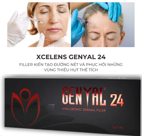 Genyal 24 – Filler kiến tạo đường nét hoàn hảo và phục hồi vùng thiếu hụt thể tích 1ml