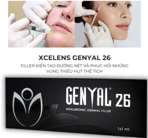 Genyal 26 – Filler kiến tạo đường nét hoàn hảo, phục hồi vùng thiếu hụt thể tích 1ml