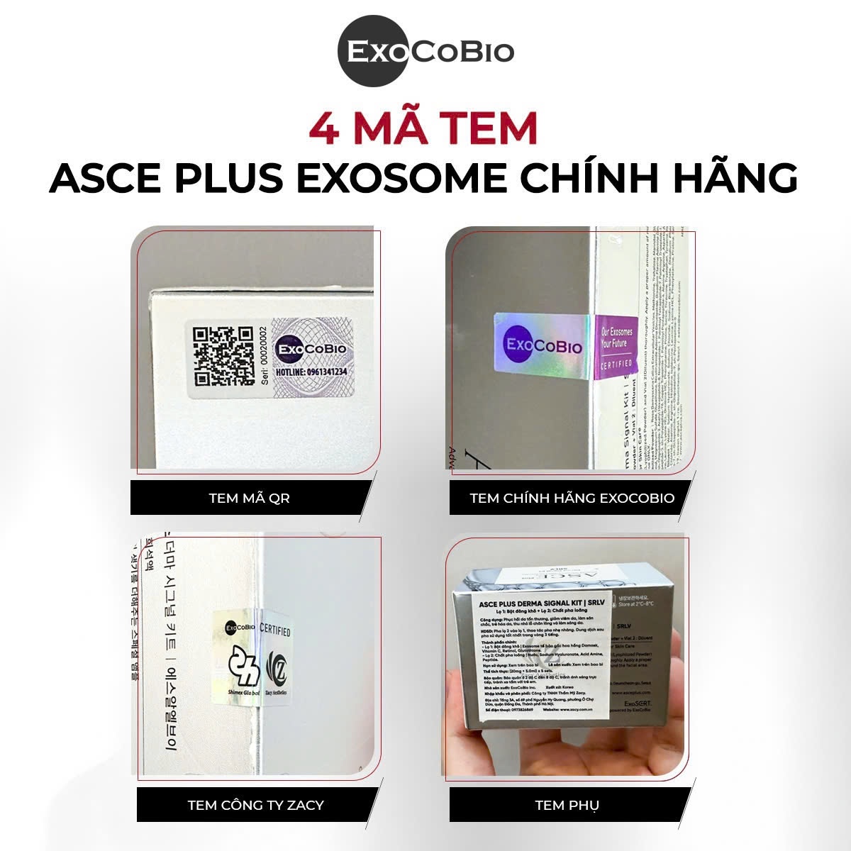 Cấy căng bóng Exosome Asce Hàn Quốc - Tinh chất căng bóng da tế bào gốc