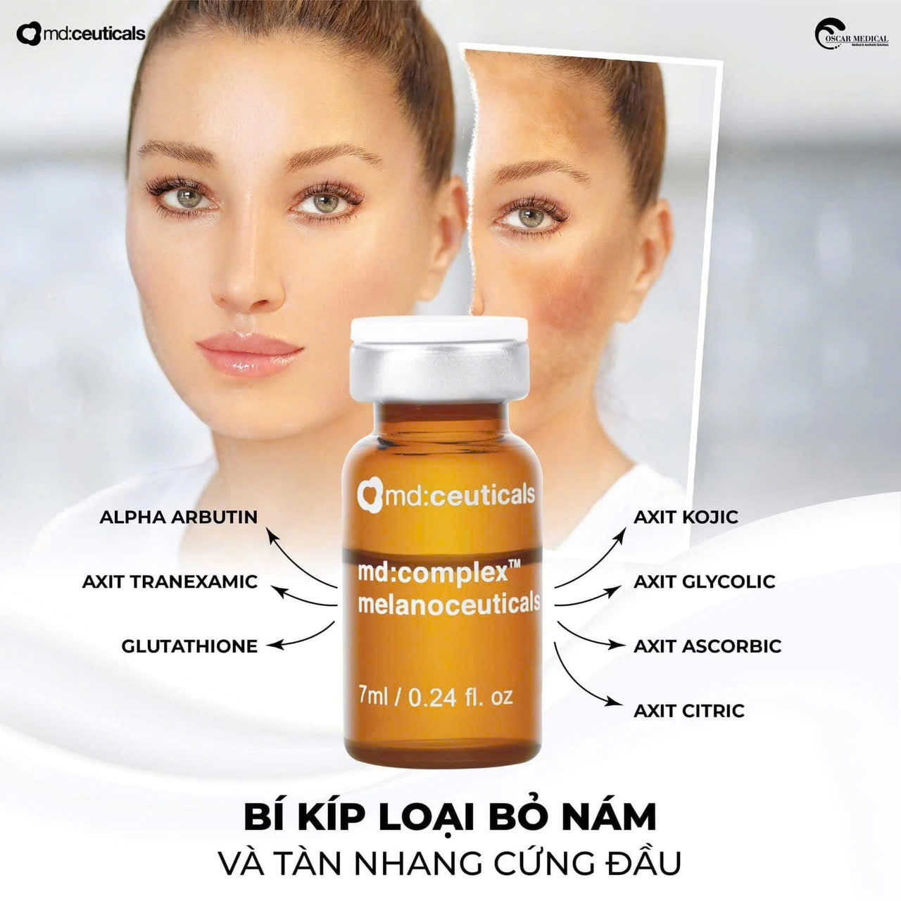 Meso loại bỏ nám Md:Complex Melanoceuticals MD: Ceuticals 7ml