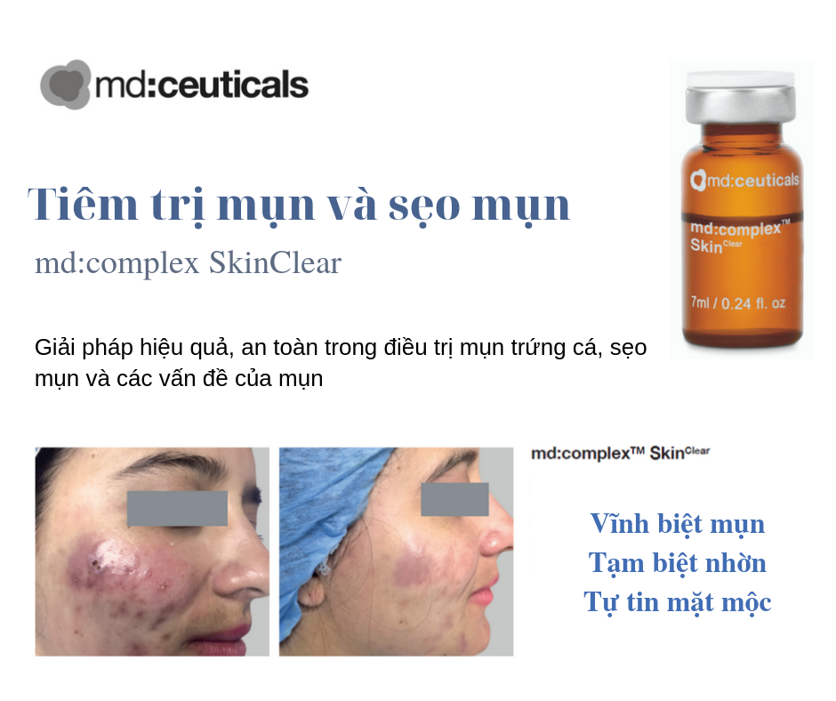 Meso trị mụn Md:Complex Skinclear  MD: Ceuticals 7ml gom khô mụi viêm hiệu quả