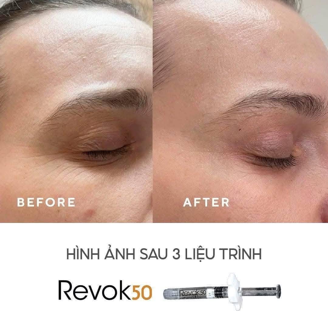 REVOK50 - Tinh chất nâng cơ, trẻ hoá toàn diện