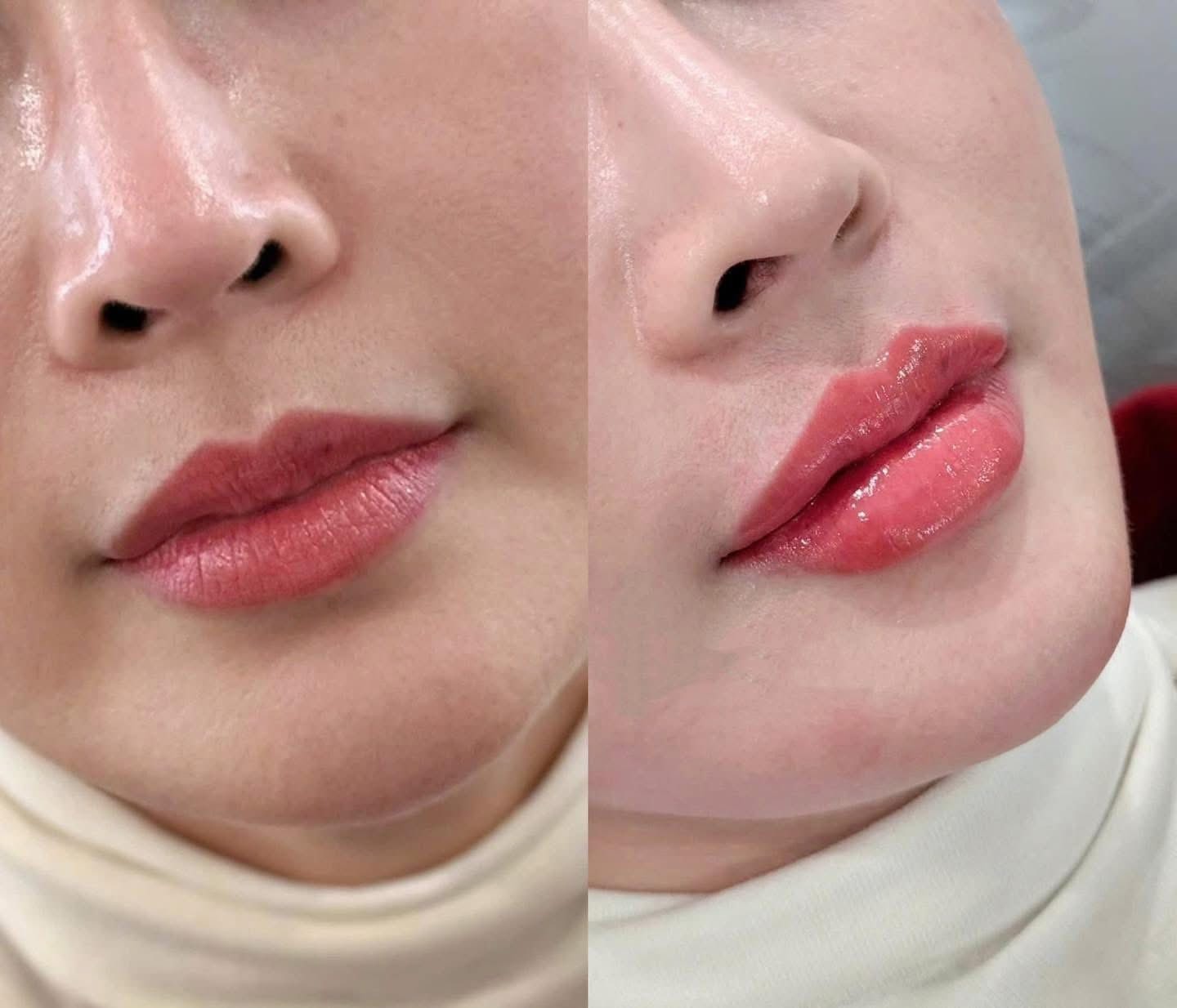 Tinh chất hồng môi Puri Lips - Hộp 1ml