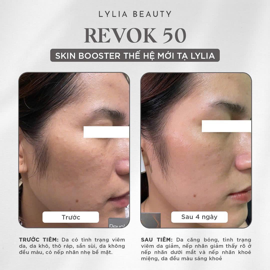 REVOK50 - Tinh chất nâng cơ, trẻ hoá toàn diện