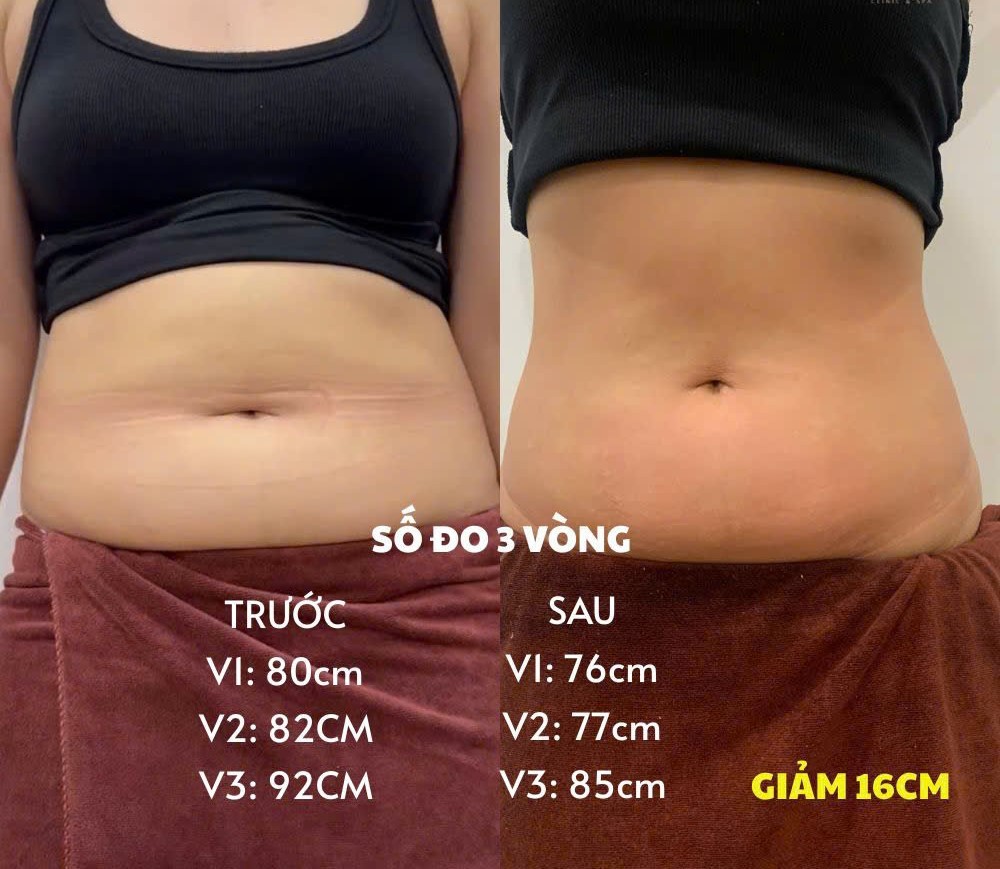 Kem massage giảm mỡ S – Shape Peptide Massage Cream