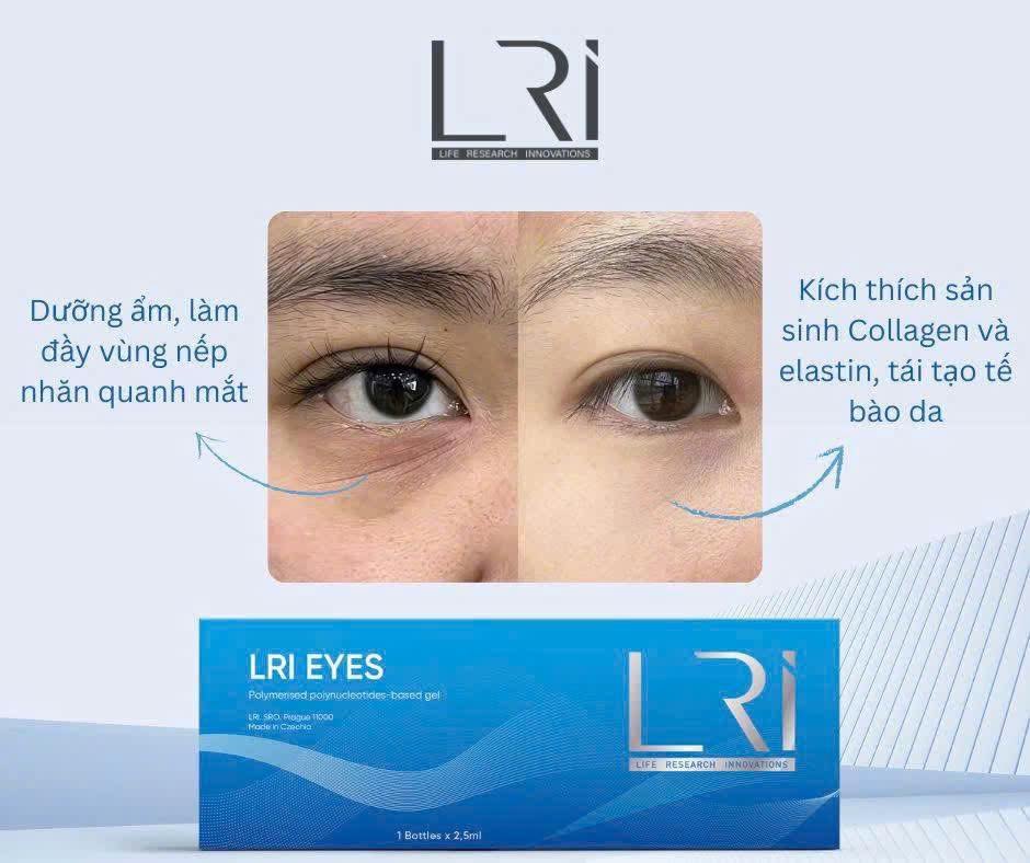 Tinh chất mờ thâm, trẻ hoá vùng mắt Lri Eyes
