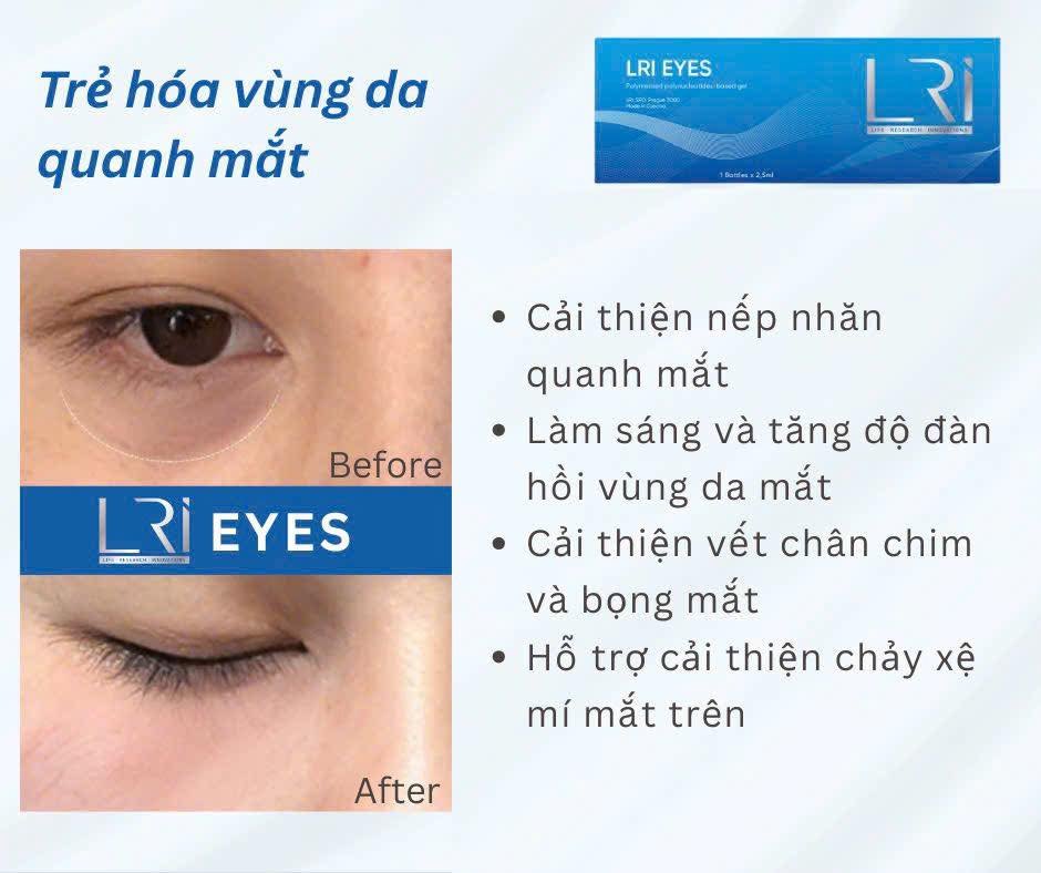 Tinh chất mờ thâm, trẻ hoá vùng mắt Lri Eyes
