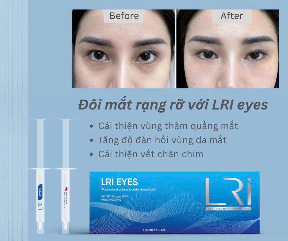 Tinh chất mờ thâm, trẻ hoá vùng mắt Lri Eyes