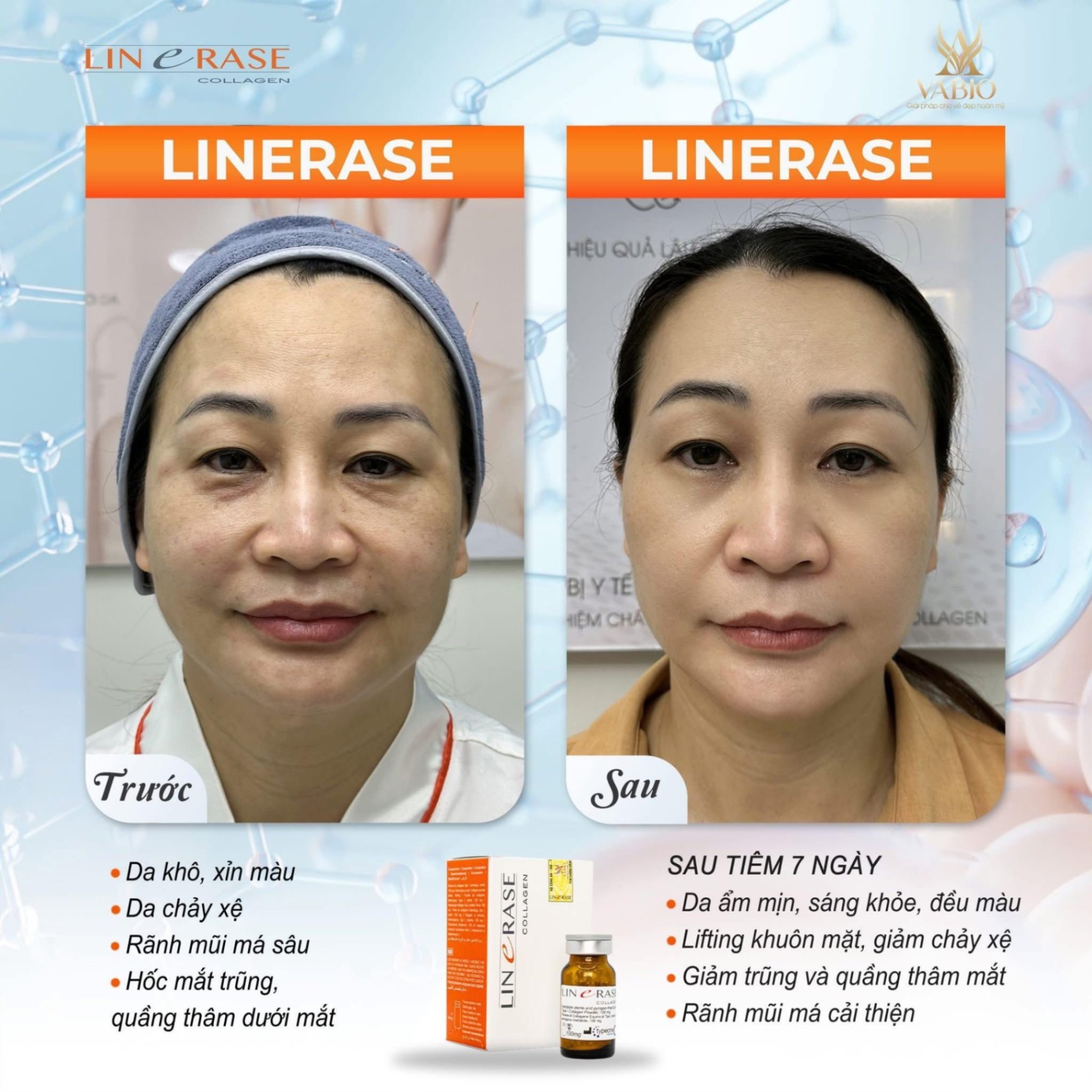 LINERASE COLLAGEN - PHỤC HỒI VÀ TÁI TẠO THẾ HỆ MỚI