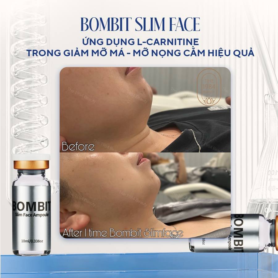 BOMBIT Slim Face thon gọn mặt, tan mỡ má, nọng cằm