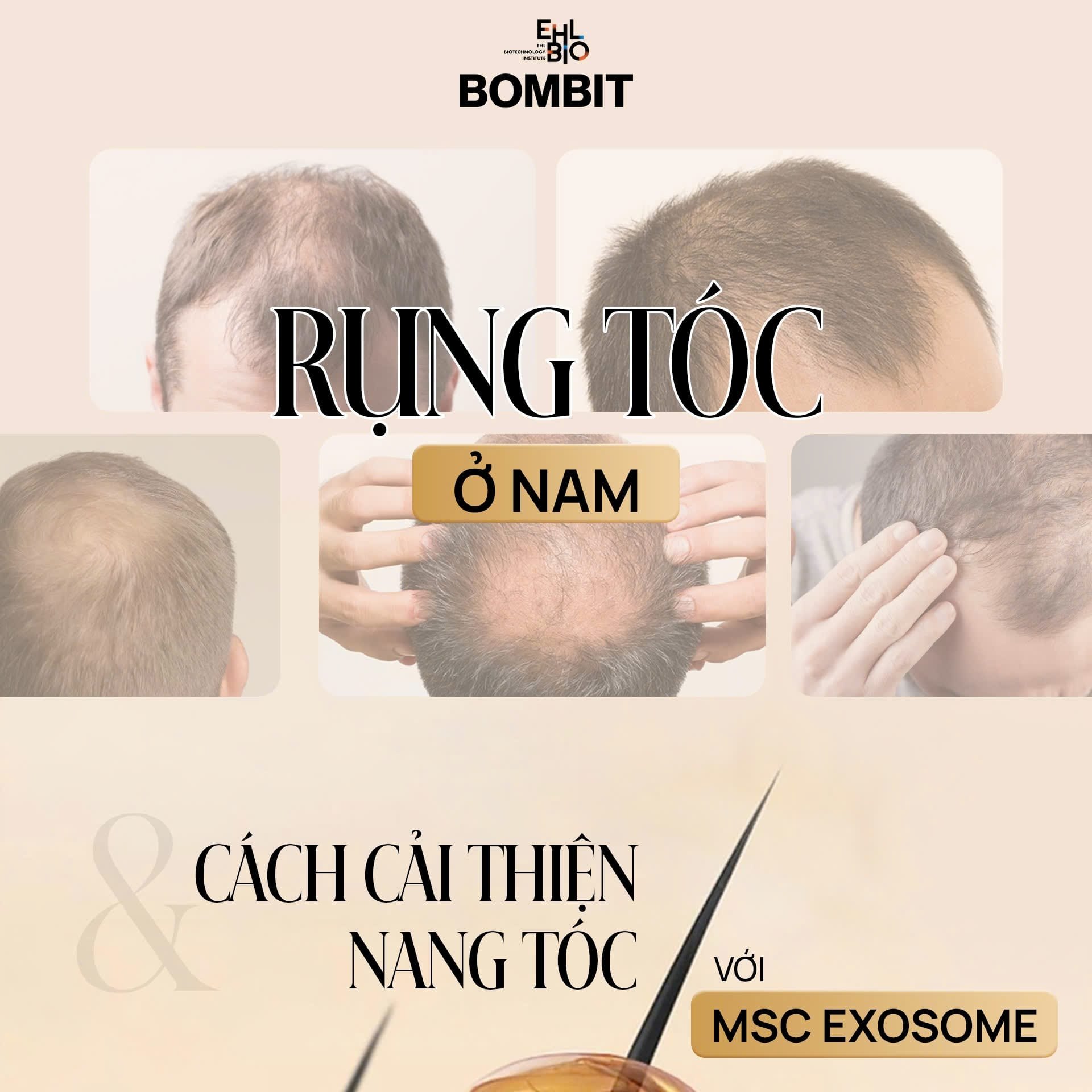 Bombit Hair Meso MSC Exosome hổ trợ mọc tóc, giảm rụng tóc
