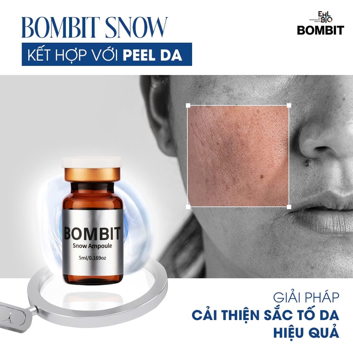 BOMBIT Snow Meso hỗ trợ điều trị nám, làm trắng da