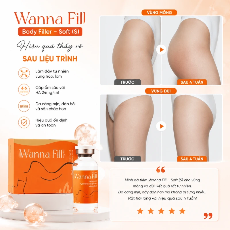 Chất Làm Đầy Body Wanna Fill Soft S Chính Hãng