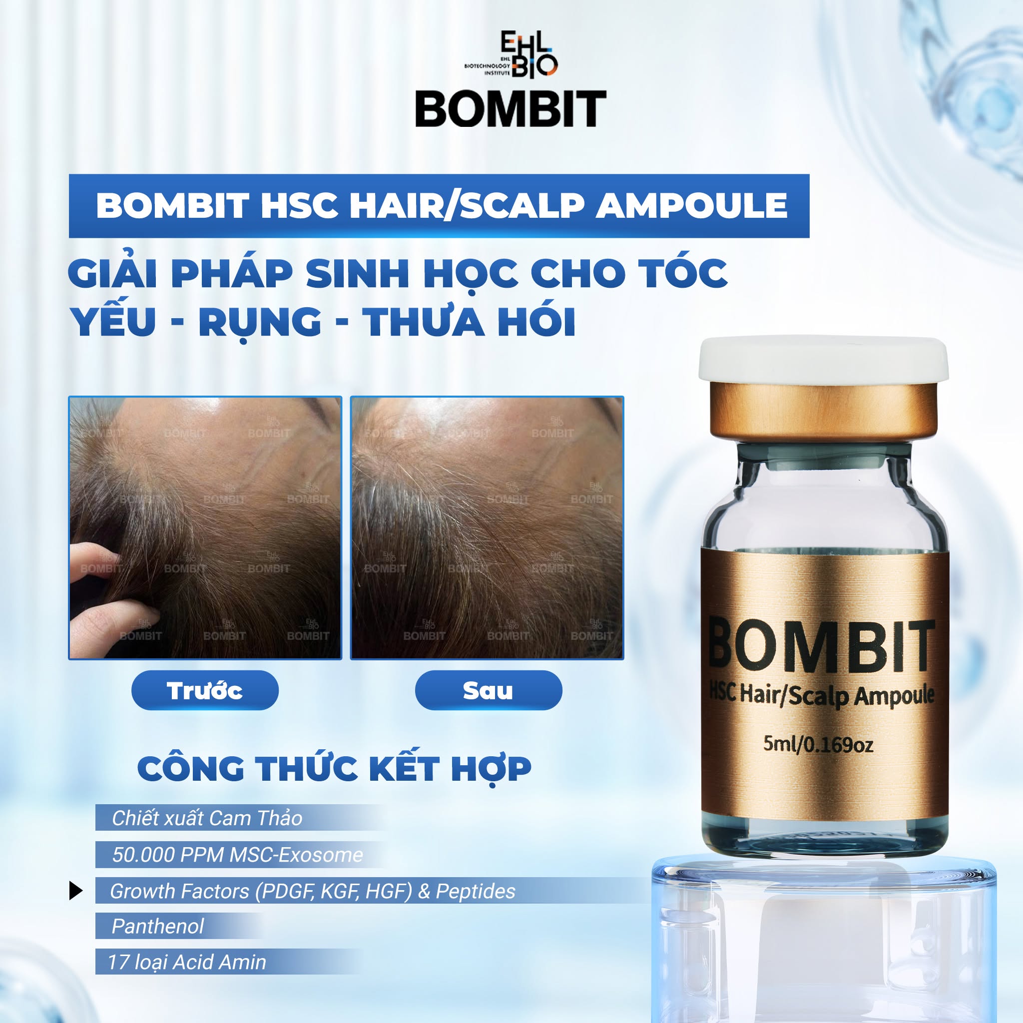 Bombit Hair Meso MSC Exosome hổ trợ mọc tóc, giảm rụng tóc