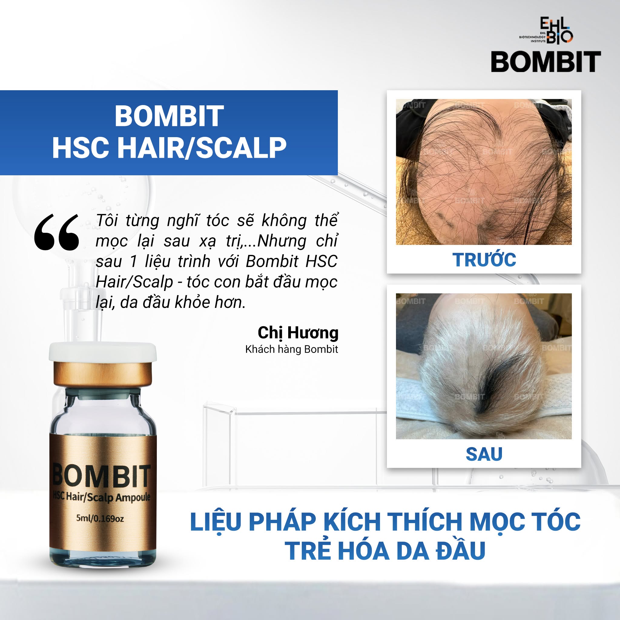 Bombit Hair Meso MSC Exosome hổ trợ mọc tóc, giảm rụng tóc