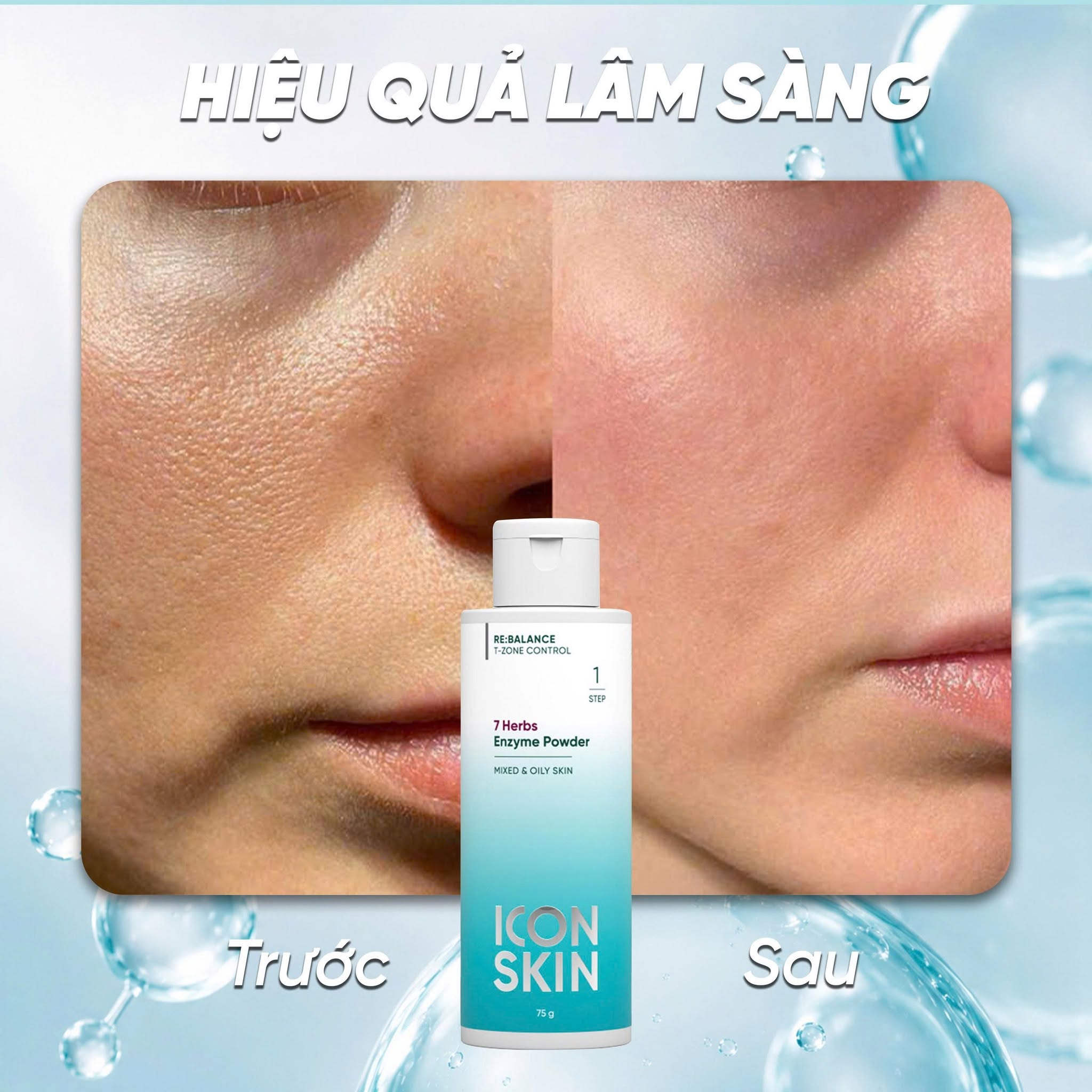 Bột tẩy da chết cho da dầu da, hỗn hợp Icon Skin 7 Herbs Enzyme Cleansing Powder