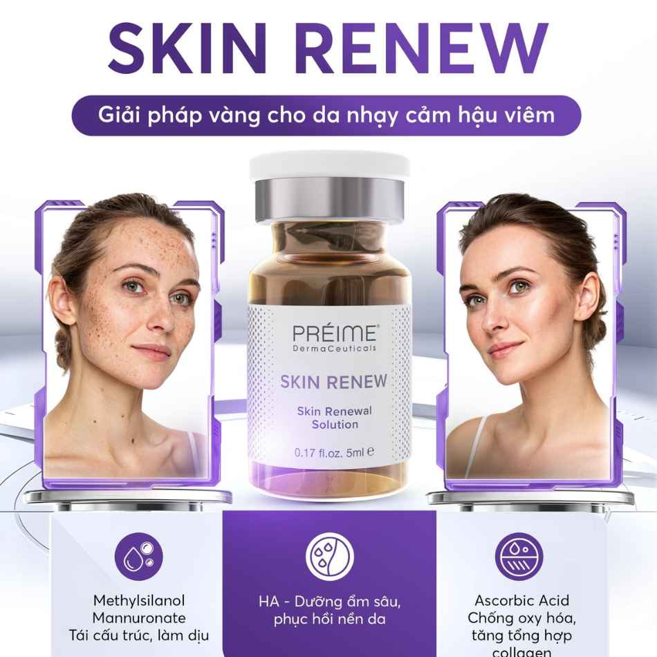 Dung dịch trẻ hóa Préime DermaCeuticals Skin Renewal Solution