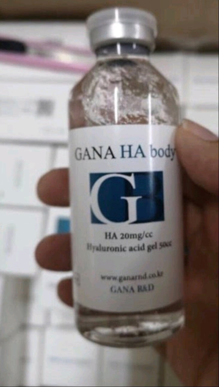 Filler Body Gana – Chất Làm Đầy Thể Tích Cơ Thể Cao Cấp Hàn Quốc