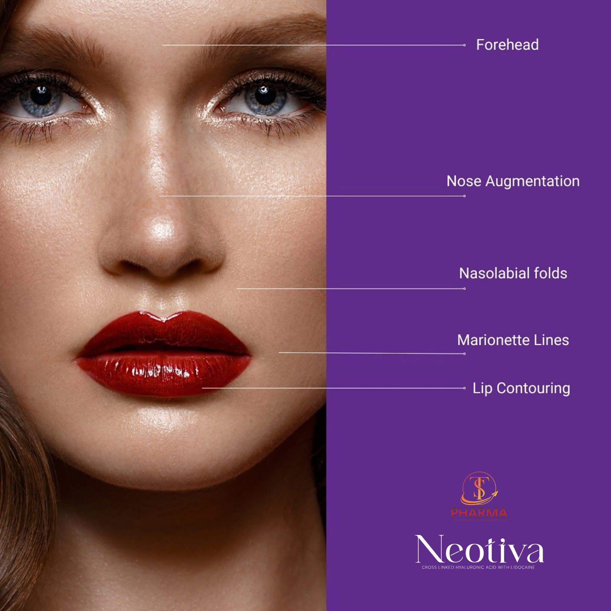 Filler HA Làm Đầy Rãnh Cười, Tạo Hình Tự Nhiên Filler Neotiva Deep+ Hàn Quốc