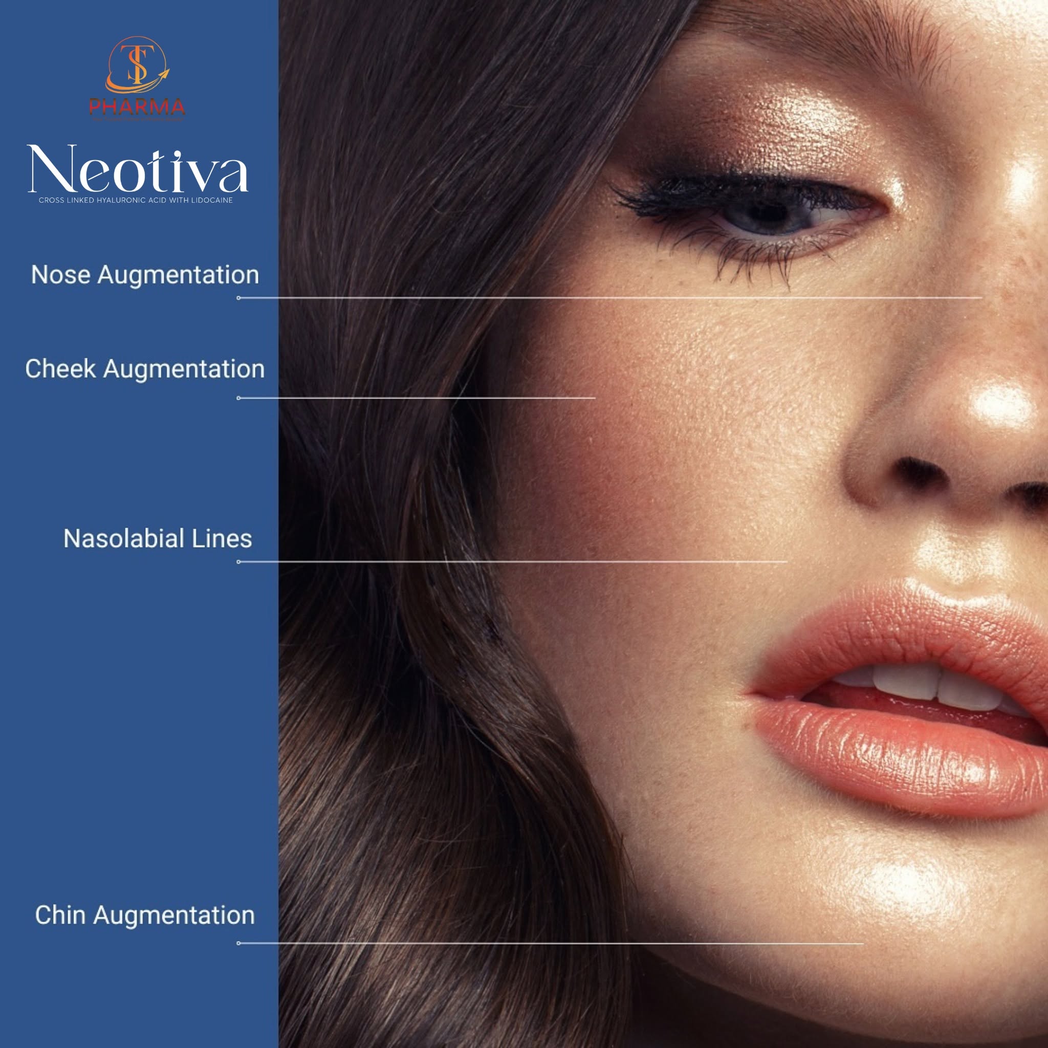 Chất Làm Đầy HA Neotiva Volume+ Hàn Quốc Chính Hãng