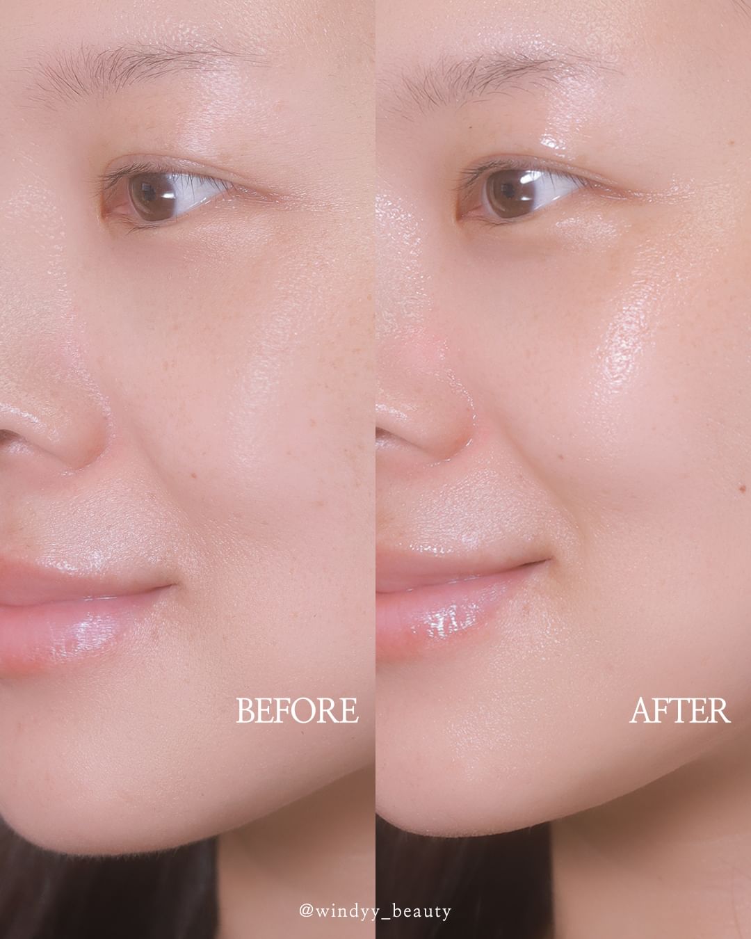 Gel Dưỡng Làm Dịu Da Glutanex Aloe Booster 200ml Cấp Ẩm Sâu