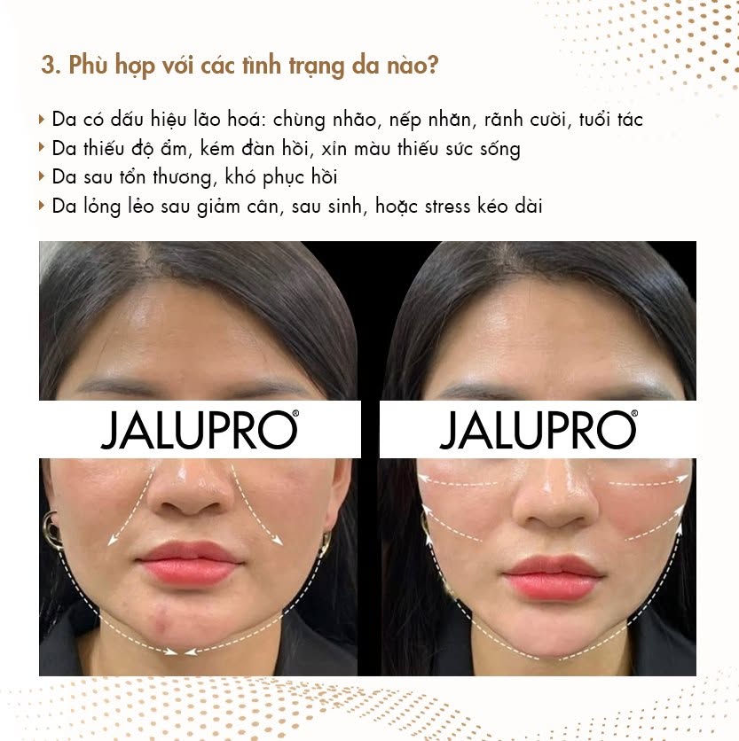 JALUPRO SUPER HYDRO - TINH CHẤT NÂNG CƠ VÀ TRẺ HÓA DA HÀNG CÔNG TY