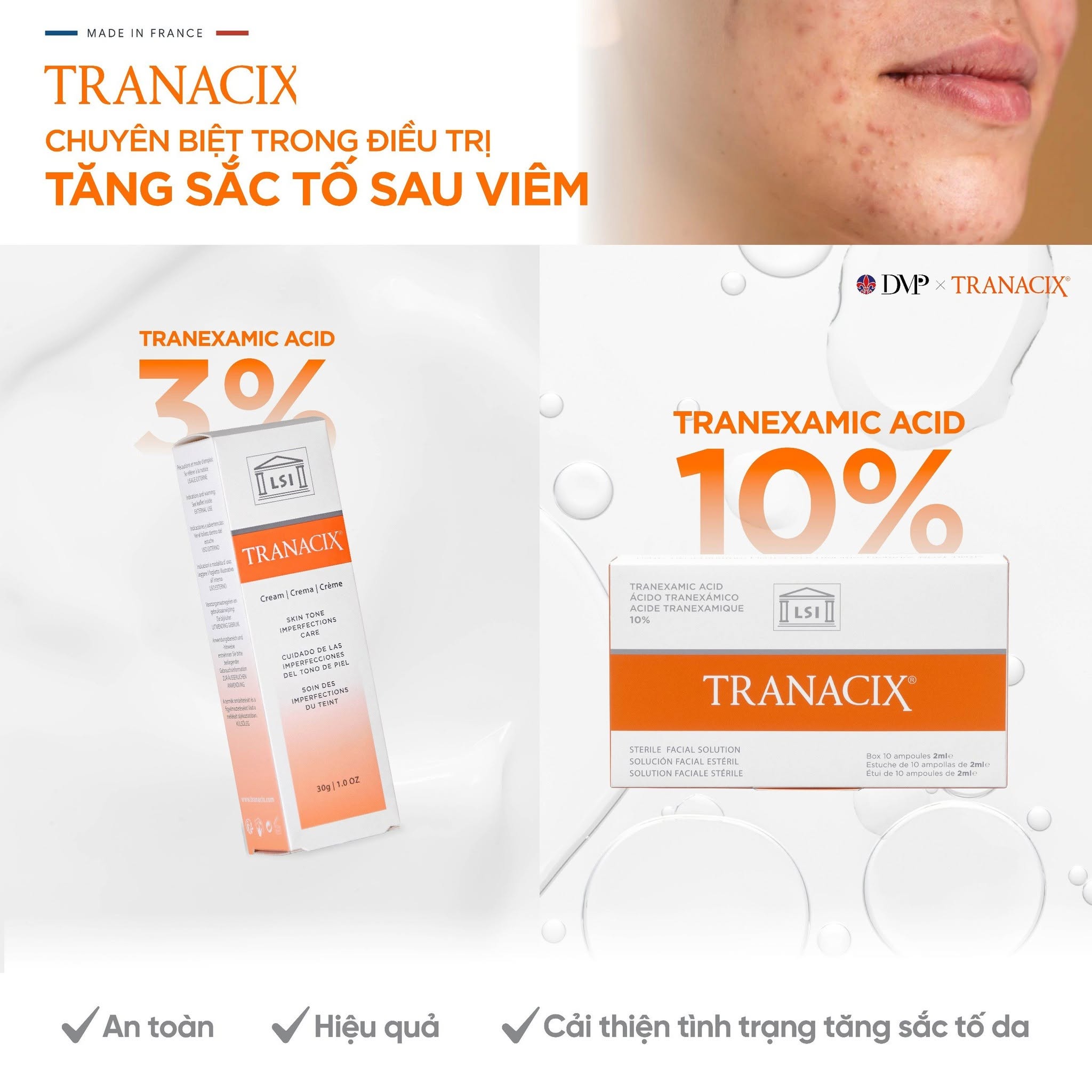 Kem Bôi Tranexamic Acid Hỗ Trợ Cải Thiện Nám, Hồng Ban Và Tăng Sắc Tố Tranacix Cream 3%