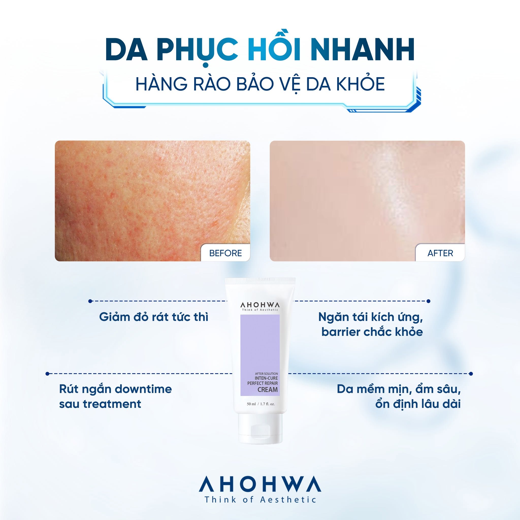 Kem tăng trưởng phục hồi da treatment Ahohwa After Solution Inten-Cure Perfect Repair Cream 50ml
