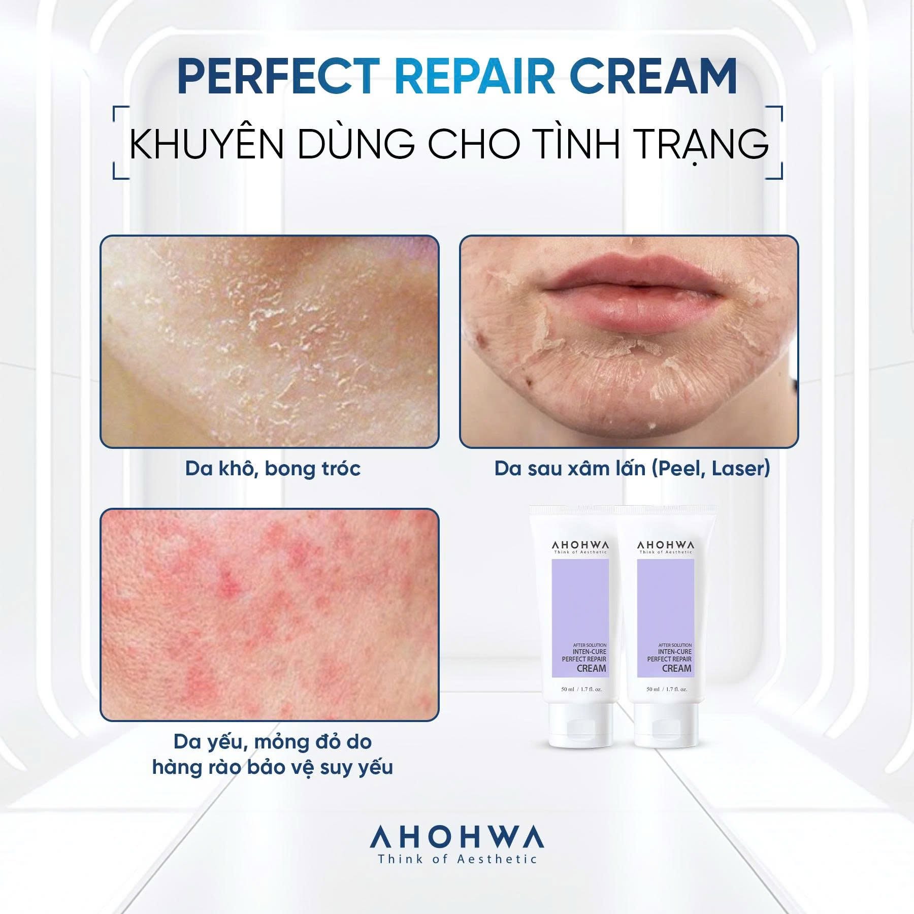 Kem tăng trưởng phục hồi da treatment Ahohwa After Solution Inten-Cure Perfect Repair Cream 50ml