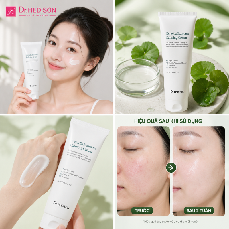 Kem Dưỡng Phục Hồi Da Nhạy Cảm Centella Exosome Calming Cream Dr.HEDISON 100ml