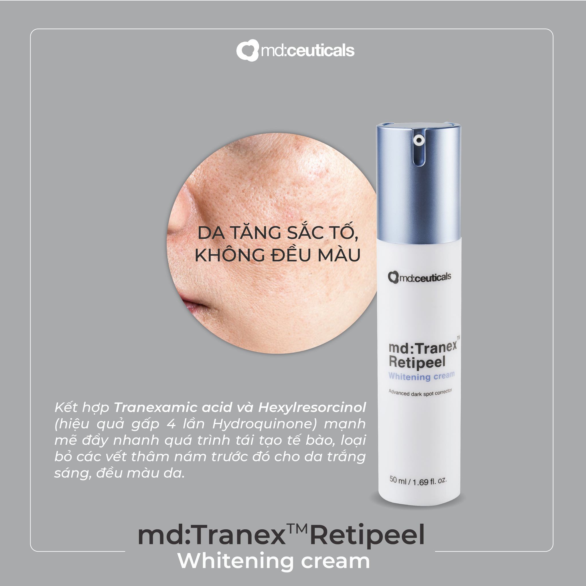 Kem Dưỡng Trắng Mờ Nám md:Tranex™ Retipeel Whitening Cream MD:Ceuticals