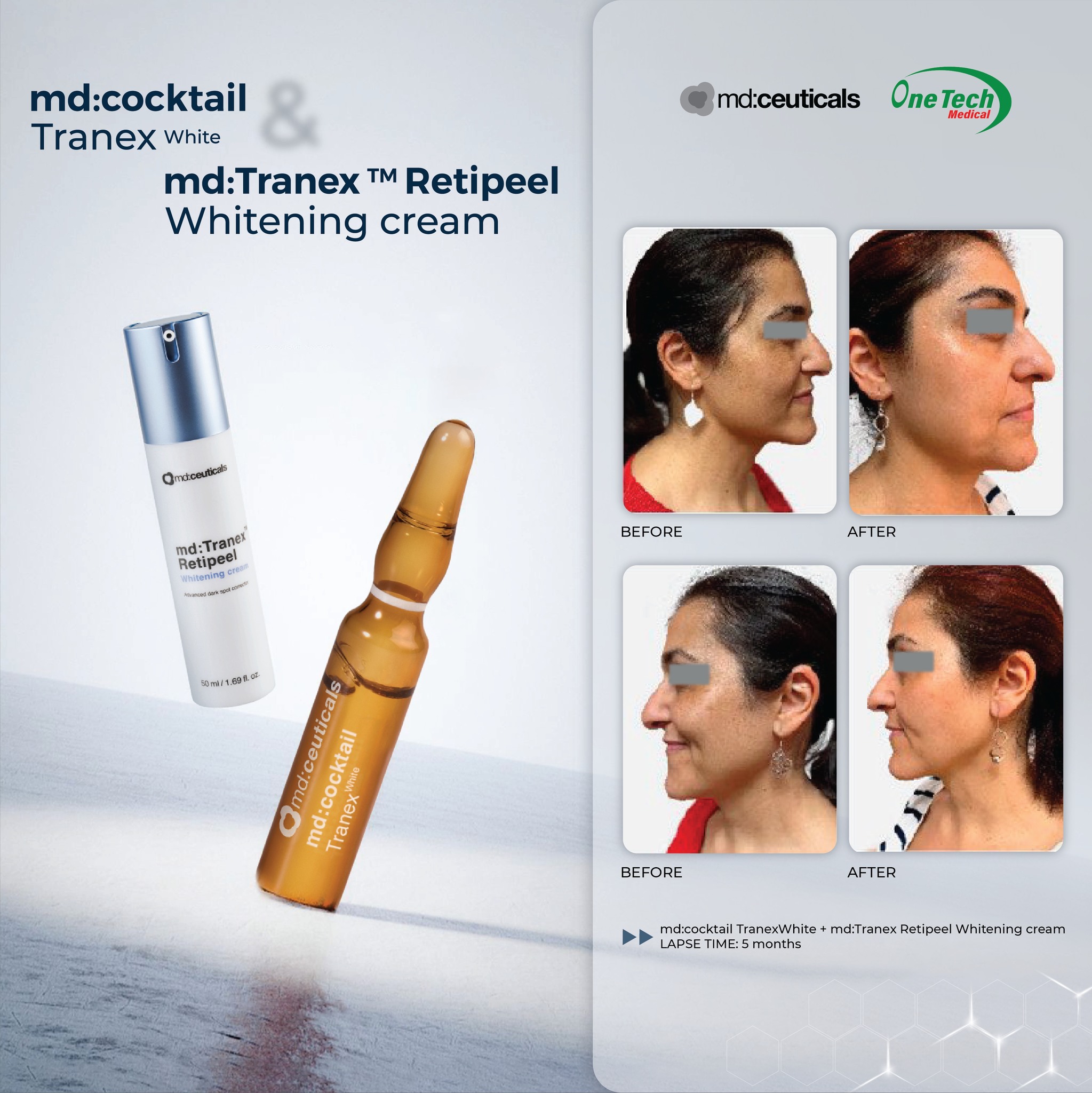 Kem Dưỡng Trắng Mờ Nám md:Tranex™ Retipeel Whitening Cream MD:Ceuticals