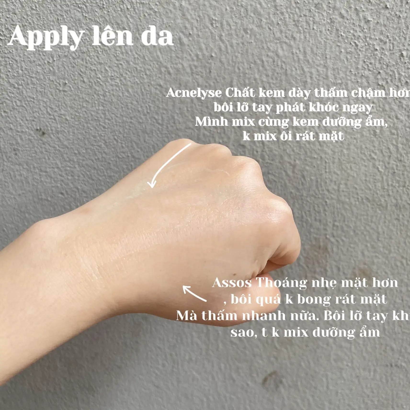 Kem Tretinoin Acnelyse 0.025% 0.05% 0.1% krem Thổ 20g