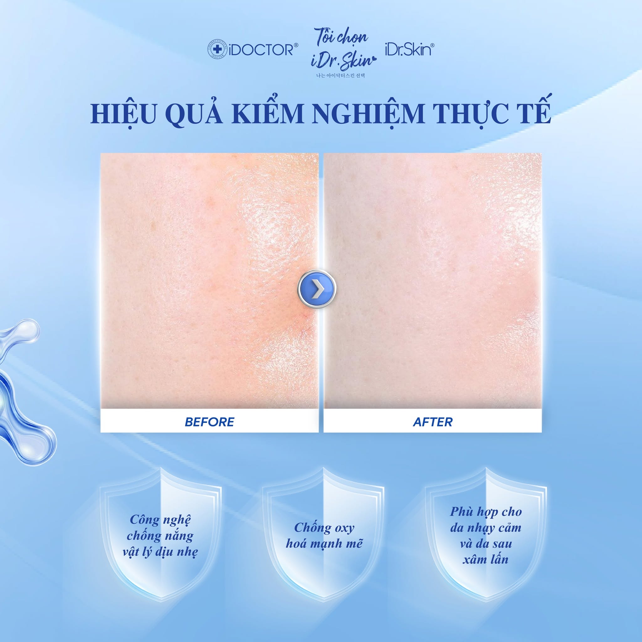 Kem chống nắng phổ rộng Idr.skin Tropical Sunblock SPF 55 PA++++