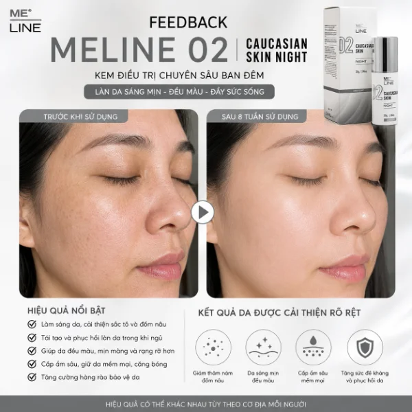 Kem hỗ trợ cải thiện nám, mụn viêm, thâm mụn Meline 02 Caucasian Skin Night