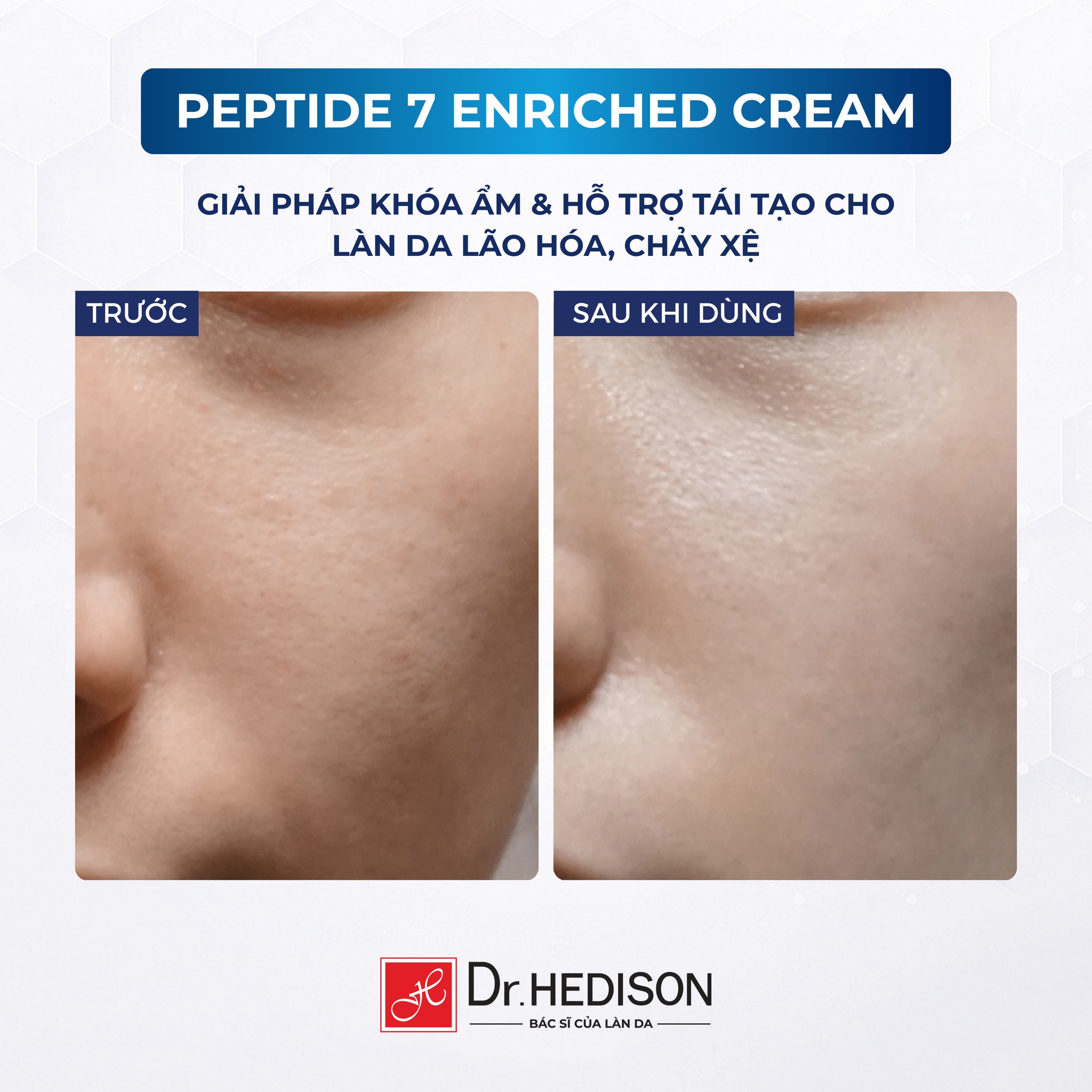 Kem dưỡng giảm nếp nhăn Peptide 7 Enriched Cream Dr.Hedison 50ml