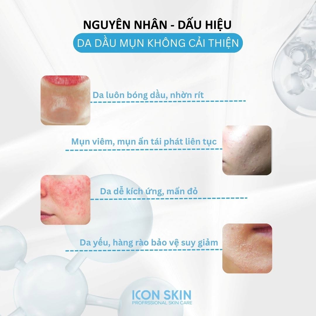 Kem dưỡng ngày cho da dầu, da hỗn hợp Icon Skin Matte & Care Day Fluid