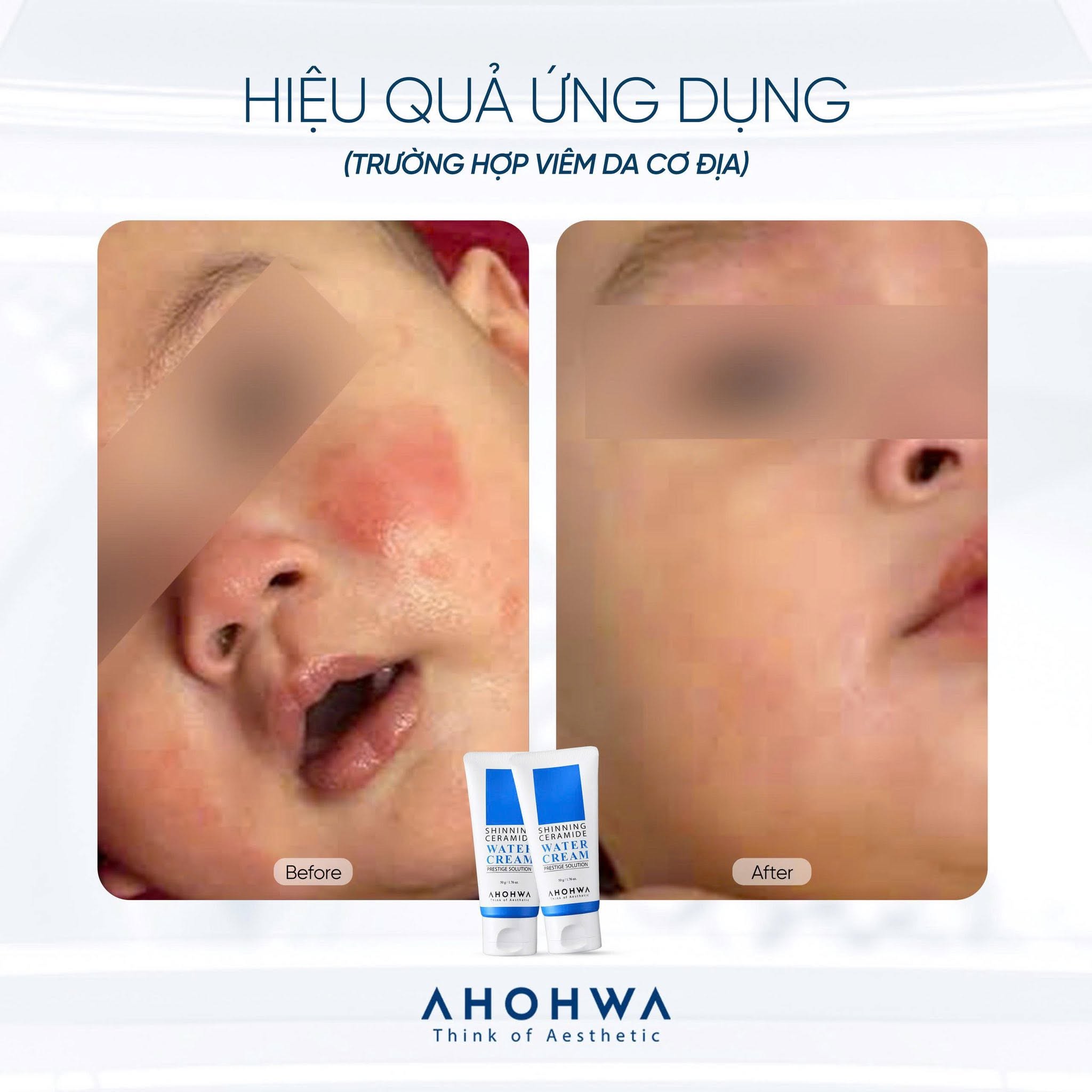 Kem dưỡng siêu cấp nước phục hồi hàng rào bảo vệ da Ahohwa Prestige Solution Shinning Ceramide Water Cream