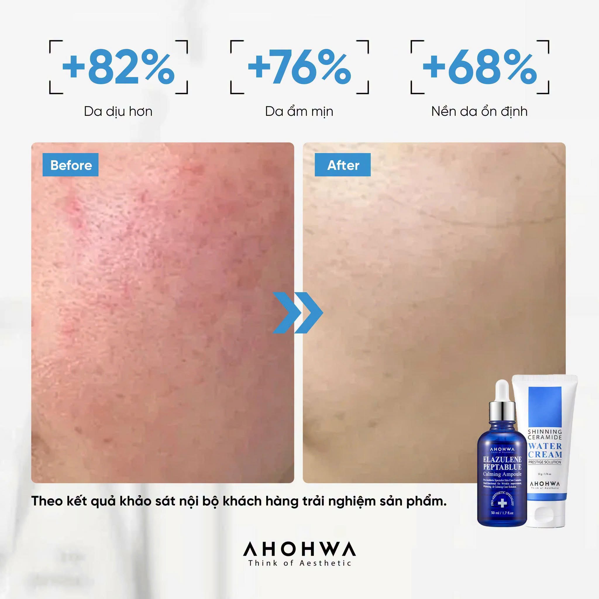 Kem dưỡng siêu cấp nước phục hồi hàng rào bảo vệ da Ahohwa Prestige Solution Shinning Ceramide Water Cream