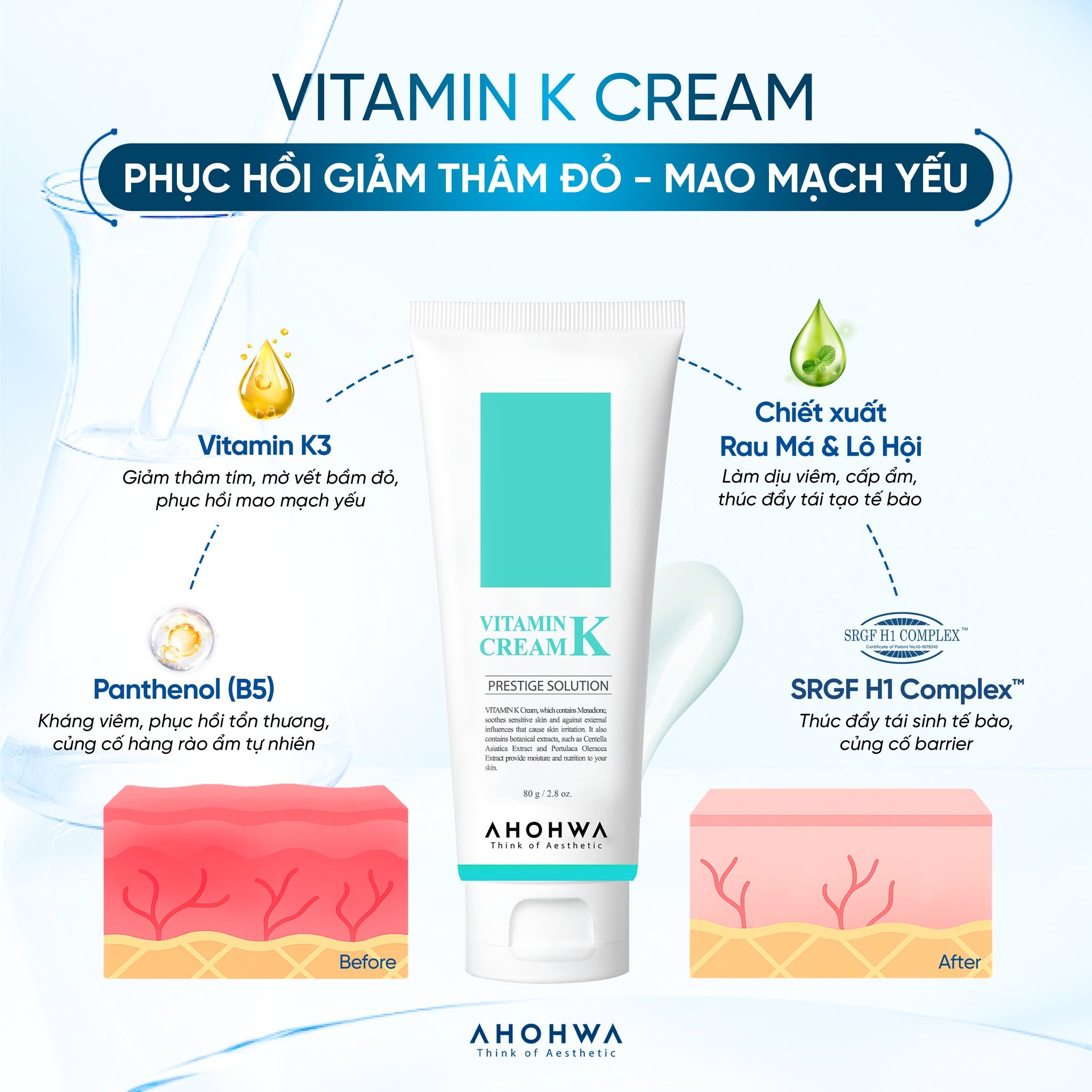 Kem phục hồi da giãn mao mạch da nhiễm corticoid Ahohwa Prestige Solution Vitamin K Cream