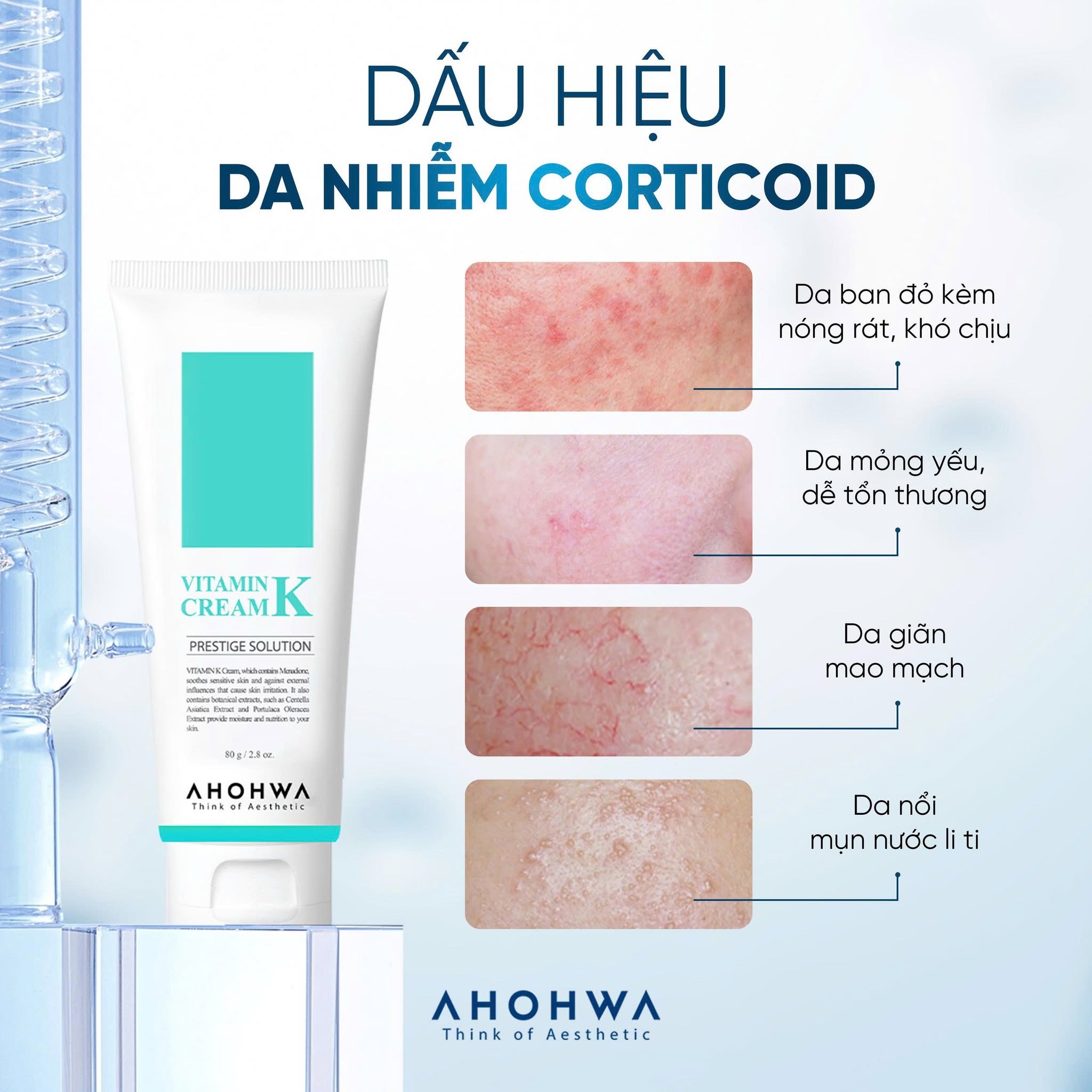 Kem phục hồi da giãn mao mạch da nhiễm corticoid Ahohwa Prestige Solution Vitamin K Cream