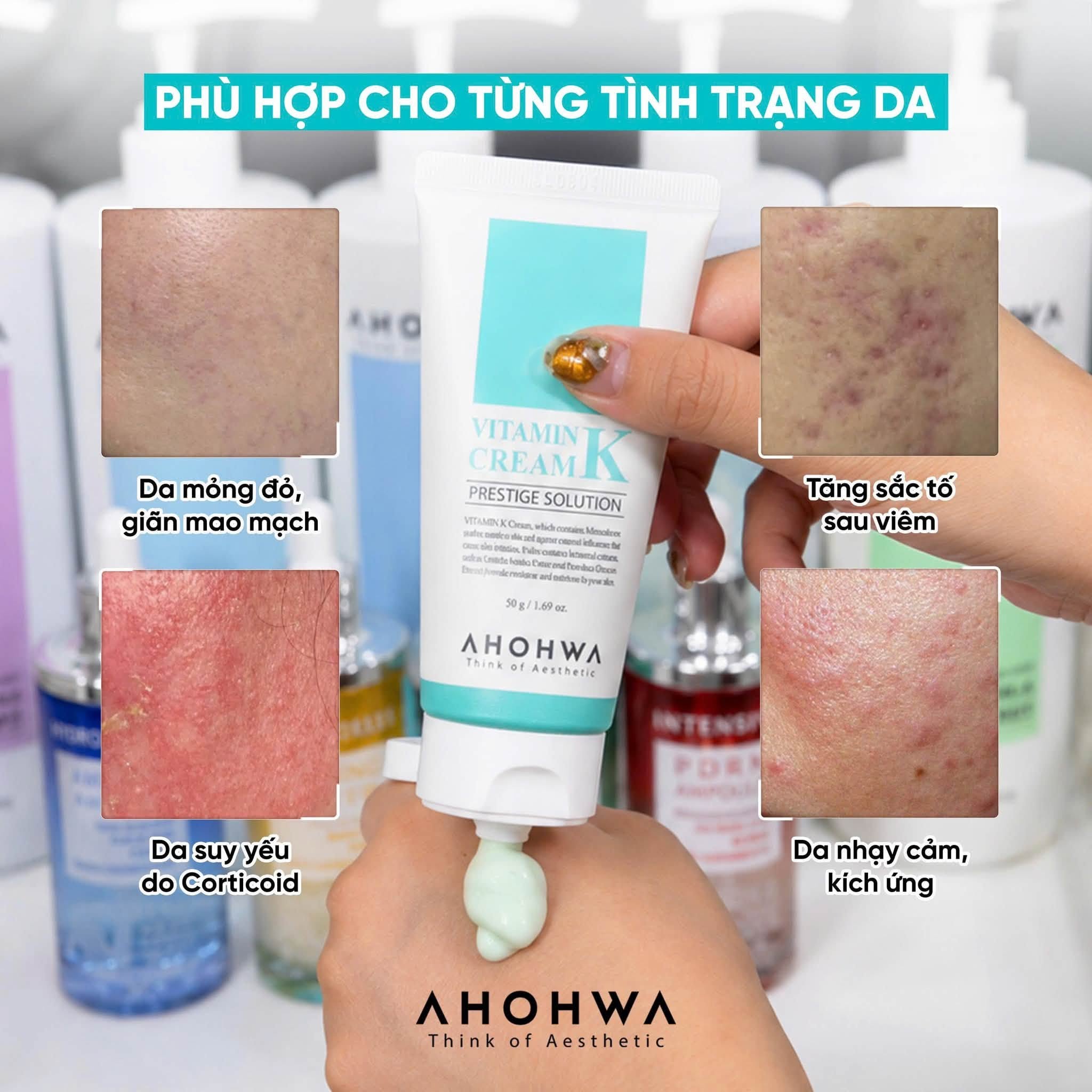 Kem phục hồi da giãn mao mạch da nhiễm corticoid Ahohwa Prestige Solution Vitamin K Cream