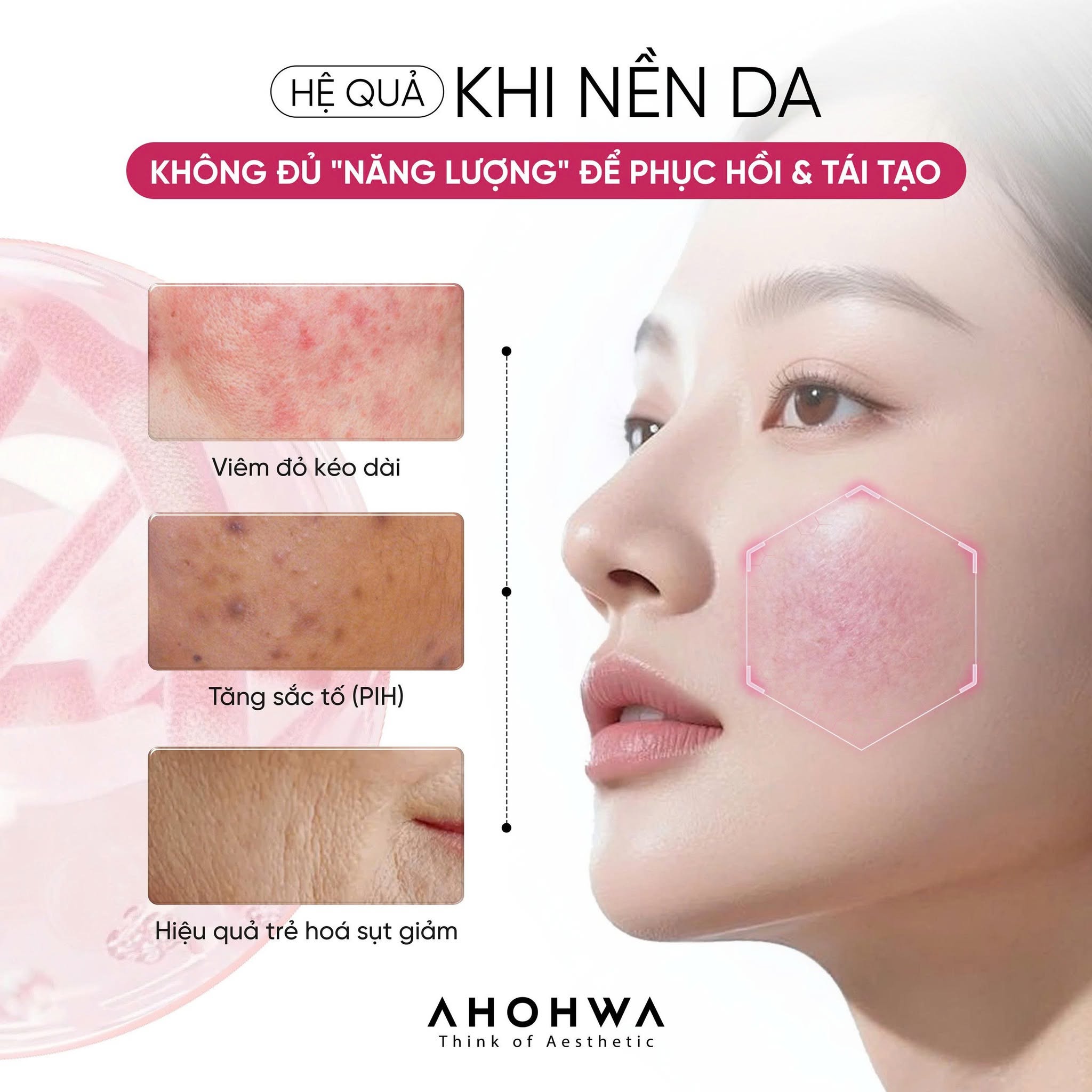 Kem tái thiết làn da nguyên bản trẻ hóa cấp độ tế bào Ahohwa Prestige Solution Intensive PDRN Cream