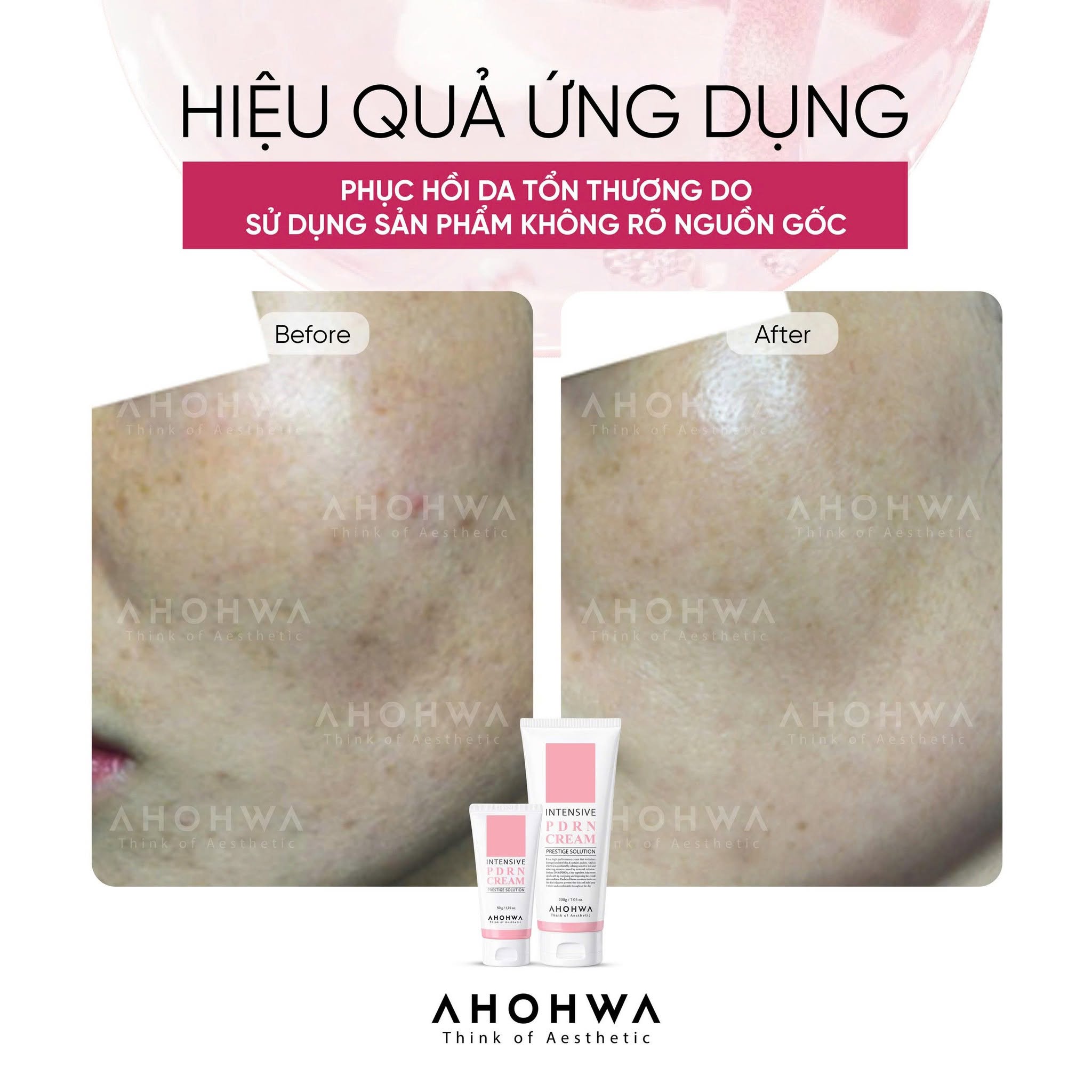 Kem tái thiết làn da nguyên bản trẻ hóa cấp độ tế bào Ahohwa Prestige Solution Intensive PDRN Cream