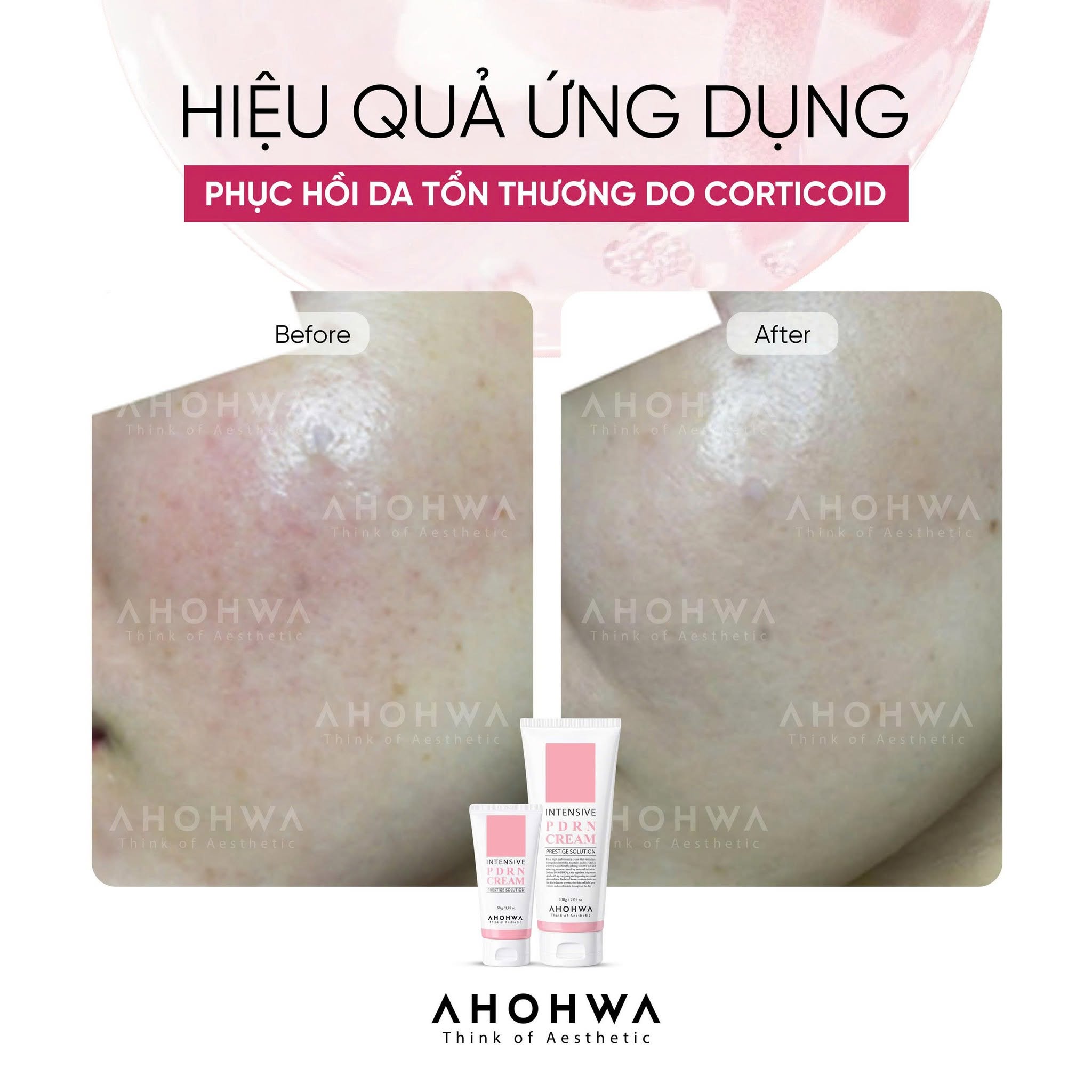 Kem tái thiết làn da nguyên bản trẻ hóa cấp độ tế bào Ahohwa Prestige Solution Intensive PDRN Cream