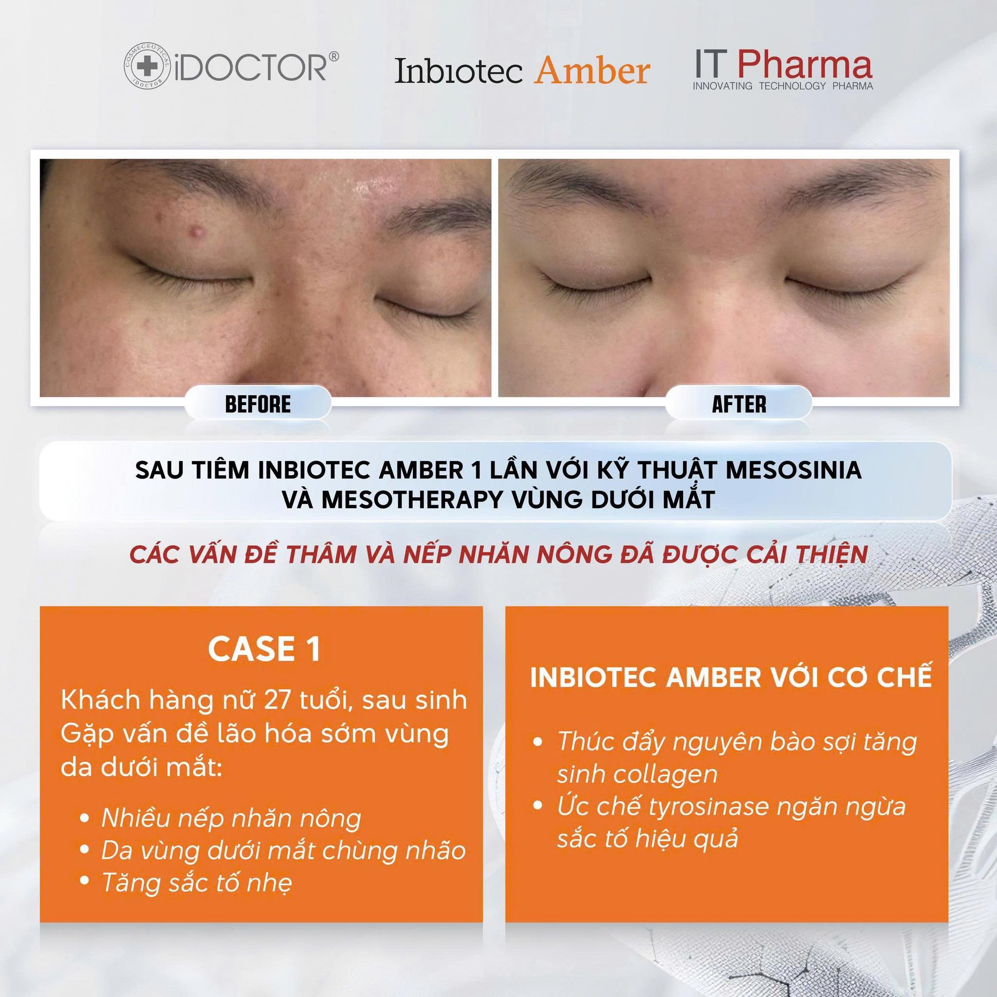 Liệu Trình Tiêm BAP Inbiotec Amber: Phác Đồ Phục Hồi & Trẻ Hóa Da Italy
