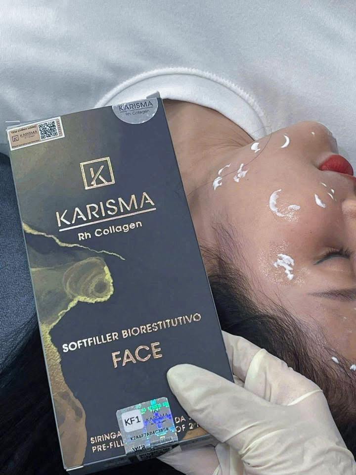 Liệu Trình Tiêm BAP Karisma: Phục Hồi Bằng Collagen Tái Tổ Hợp K15+