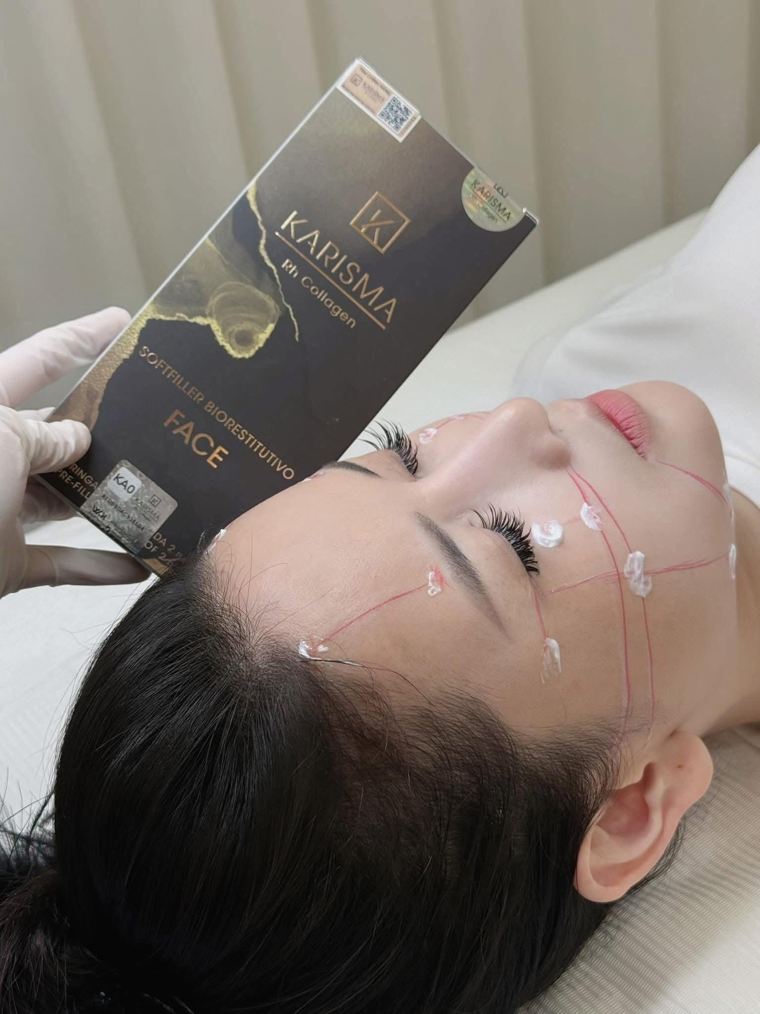 Liệu Trình Tiêm BAP Karisma: Phục Hồi Bằng Collagen Tái Tổ Hợp K15+