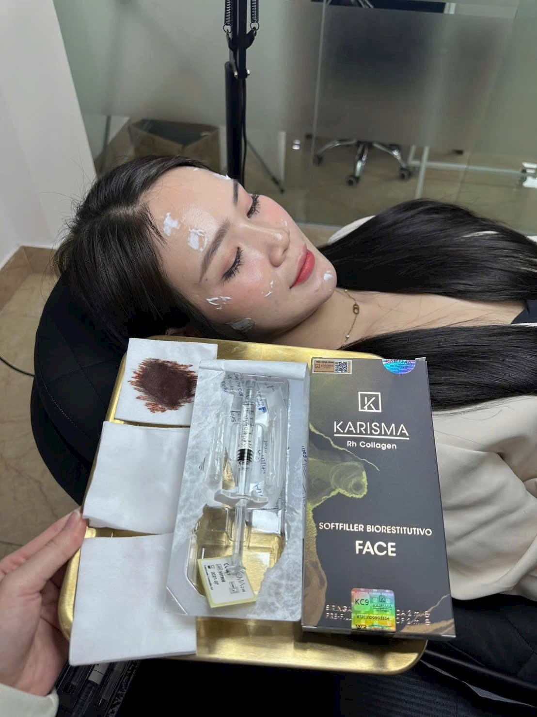 Liệu Trình Tiêm BAP Karisma: Phục Hồi Bằng Collagen Tái Tổ Hợp K15+
